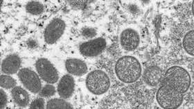 OMS emite relatório sobre ameaças de varíola