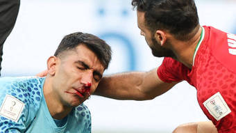 Goleiro do Irã bate cabeça com companheiro e tem suspeita de concussão – Futebol